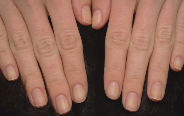 hands showing healthy nails