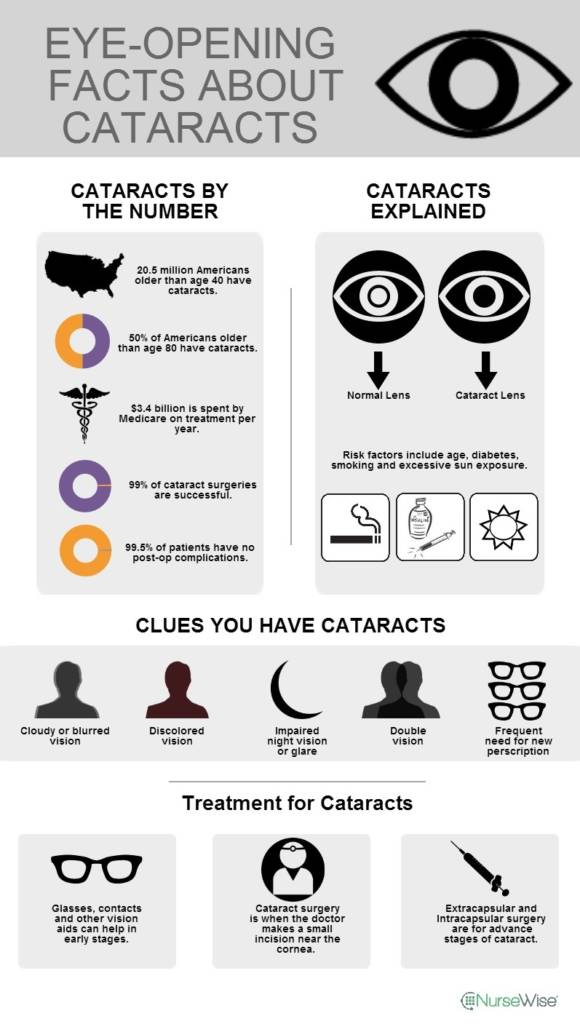 cataracts infographic