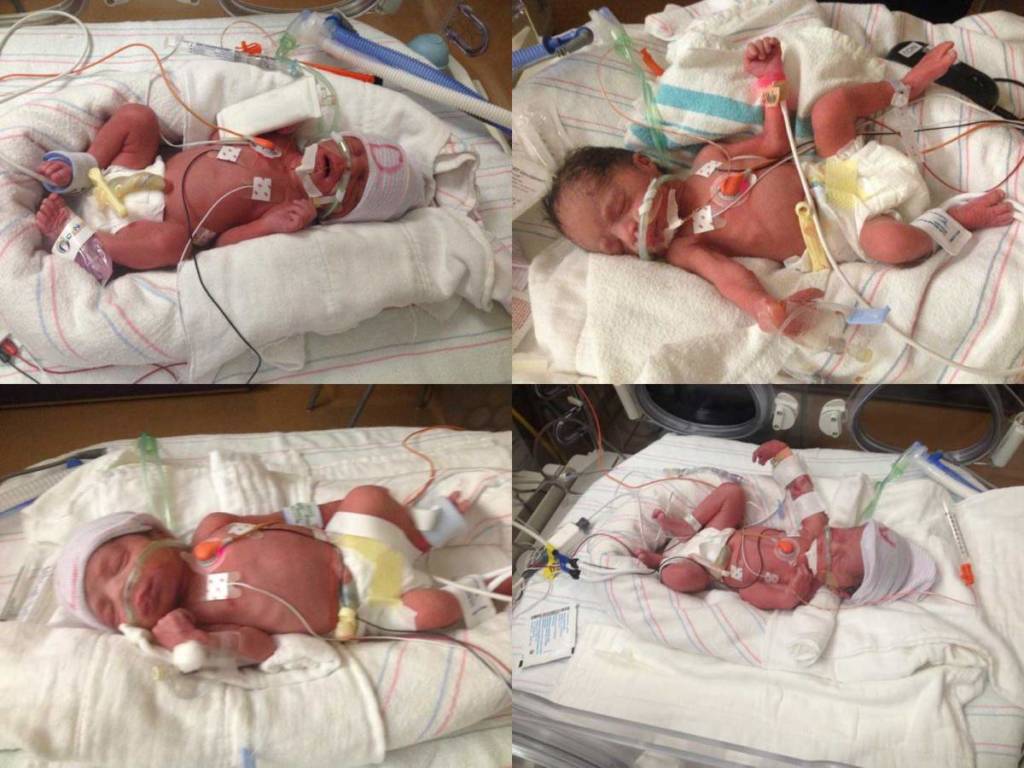 mother-dies-quadruplets