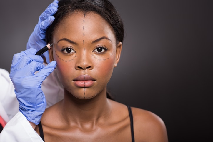 Young African American woman with plastic surgery correction marks