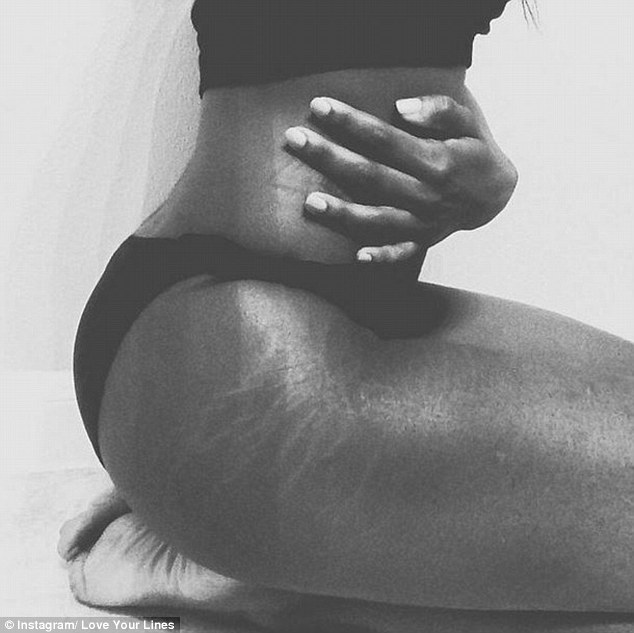 #LoveYourLines Black woman with stretch marks