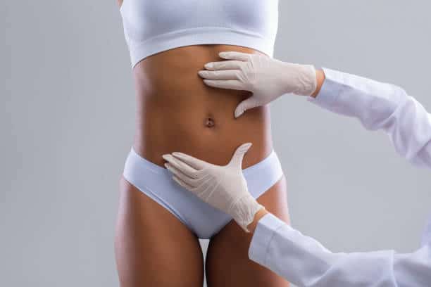 liposuction