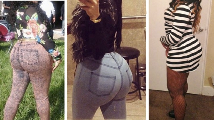 Butt Injections horror stories