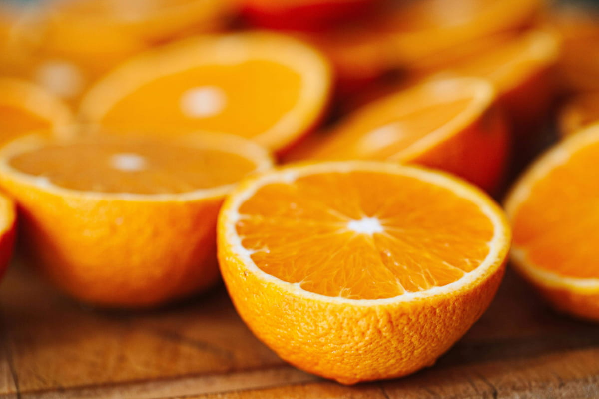 hyperpigmentation