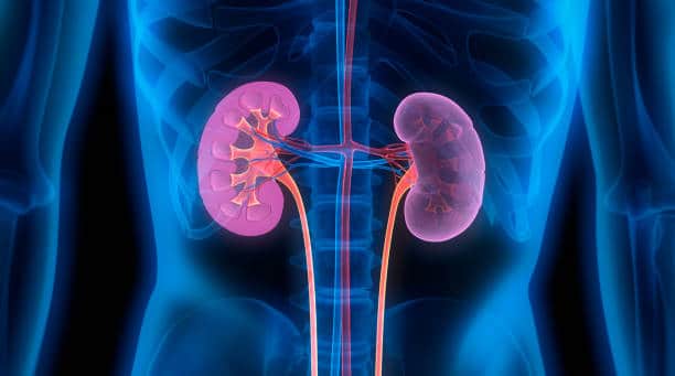 kidney transplant