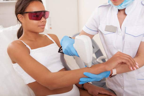 laser hair removal