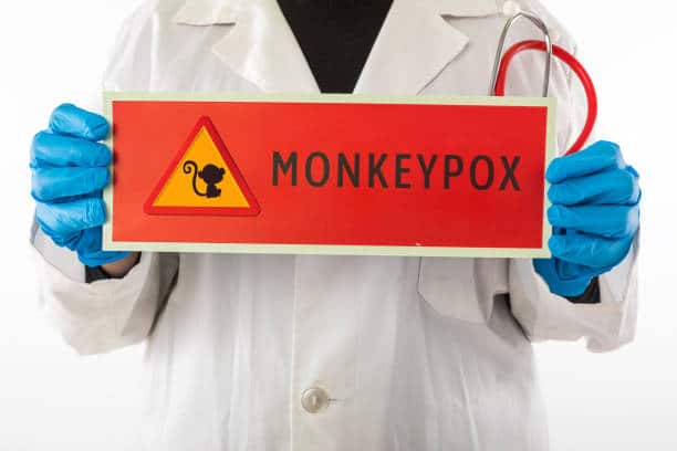monkeypox