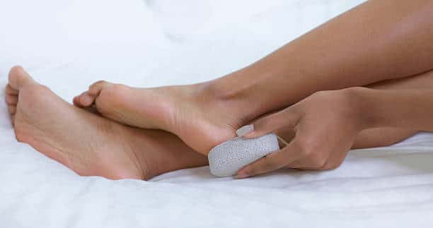 how to get rid of calluses 
