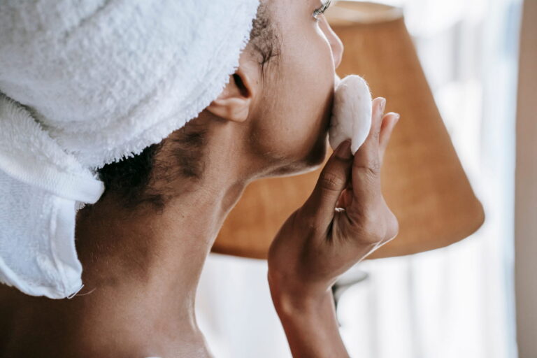 natural remedies for hyperpigmentation