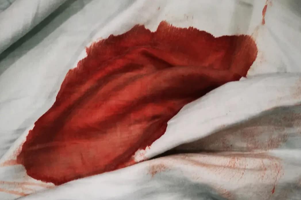 period shaming