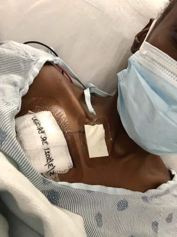 metastatic breast cancer 