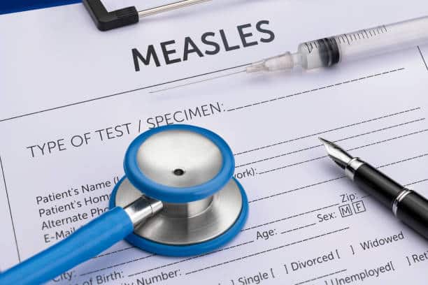measles