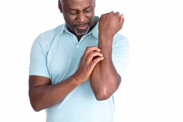 eczema or psoriasis
