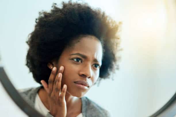 Hidradenitis suppurativa