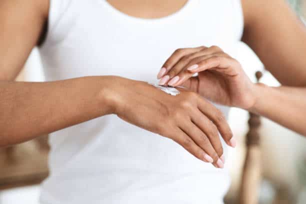 topical steroid withdrawal