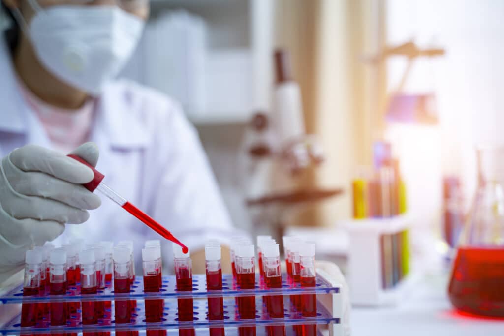 Sickle Cell Gene Therapy Clinical Trials: What Black People Should Know