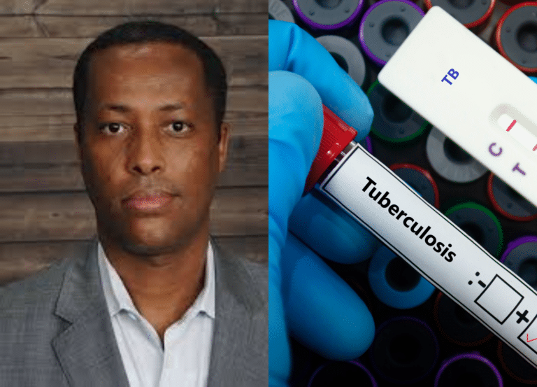 A Black Researcher Is Testing A Late-Stage Tuberculosis Vaccine