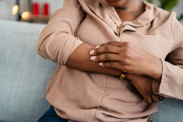 Chronic Spontaneous Urticaria