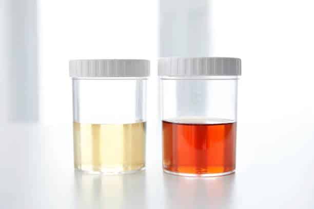 urine color
