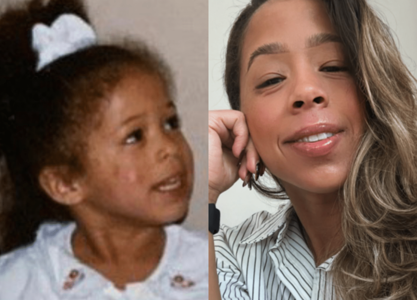 Ashely Lora Did An Eczema Clinical Trial and Found Healing and Purpose