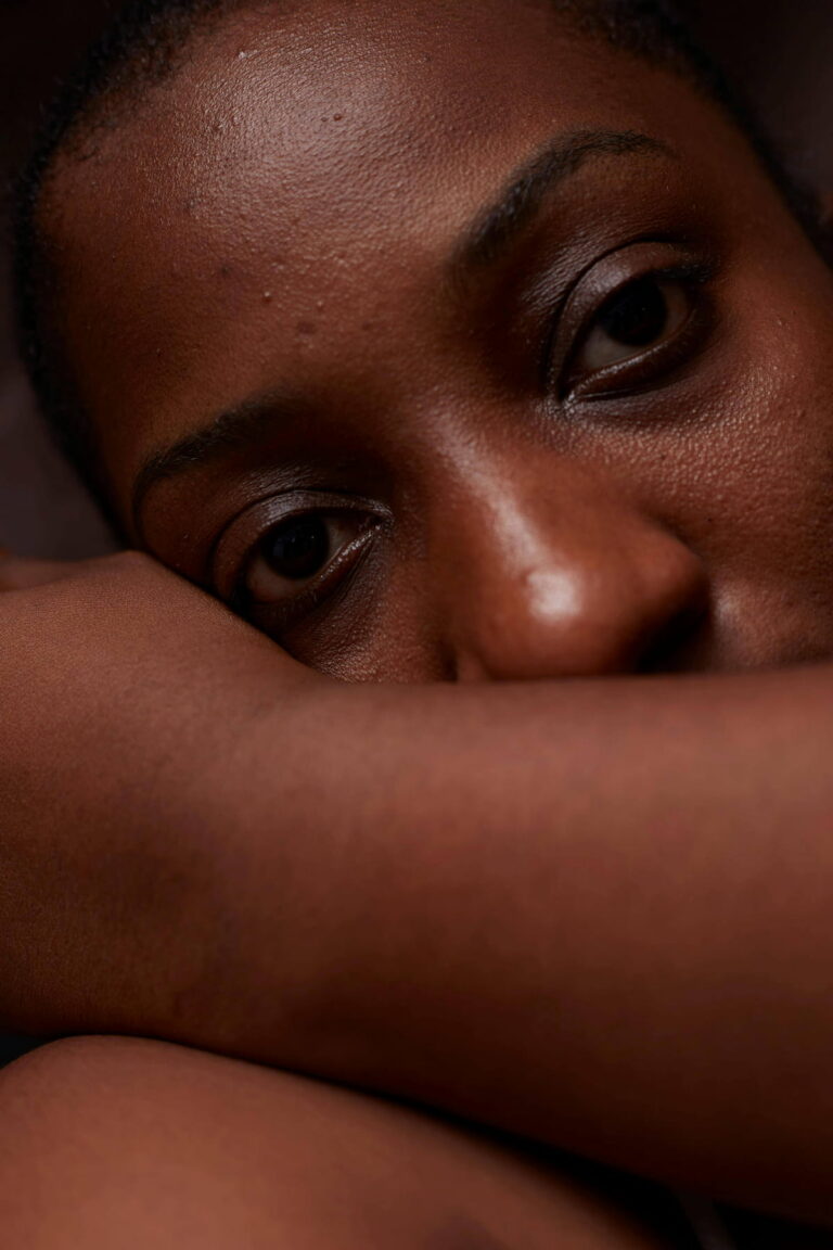 Close-up of a person with dark skin, whose arm covers their mouth and chin, with their eyes looking directly at the viewer.