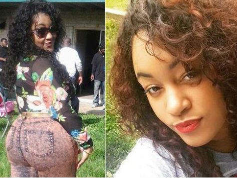 kelly-mayhew-main.jpg Butt Injections