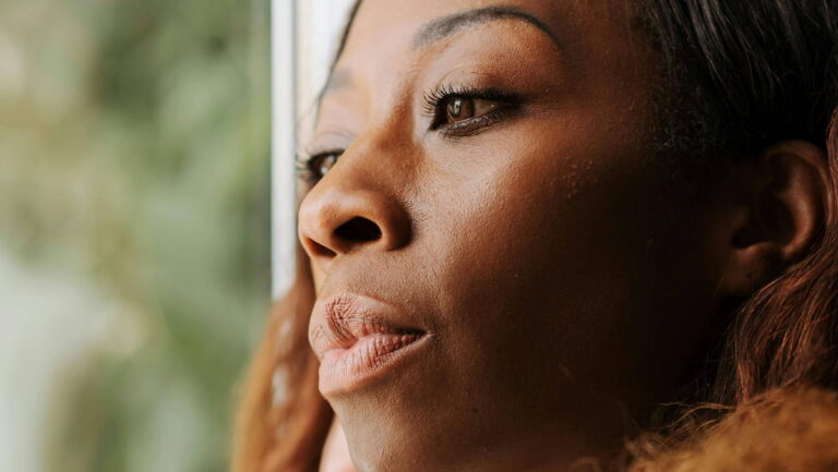 lupus symptoms