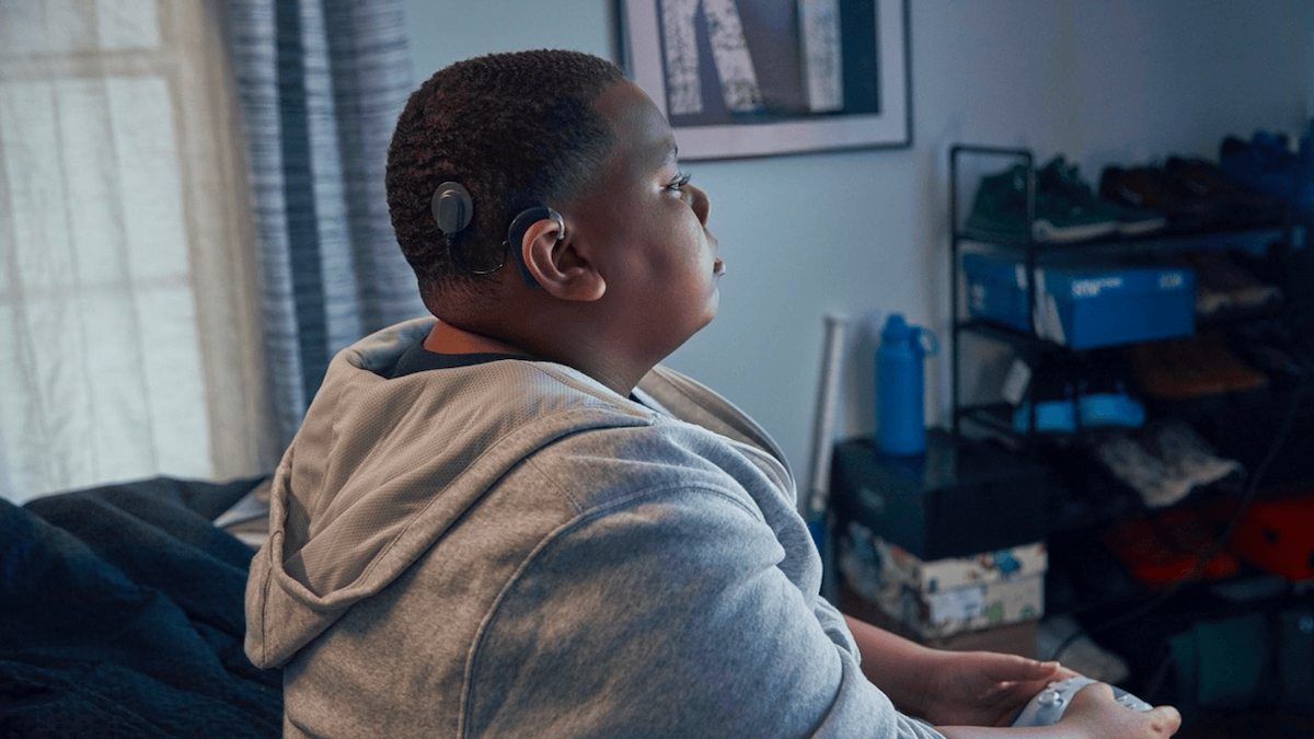 cochlear implant