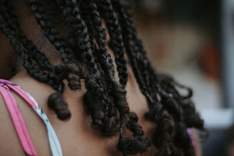 traction alopecia research
