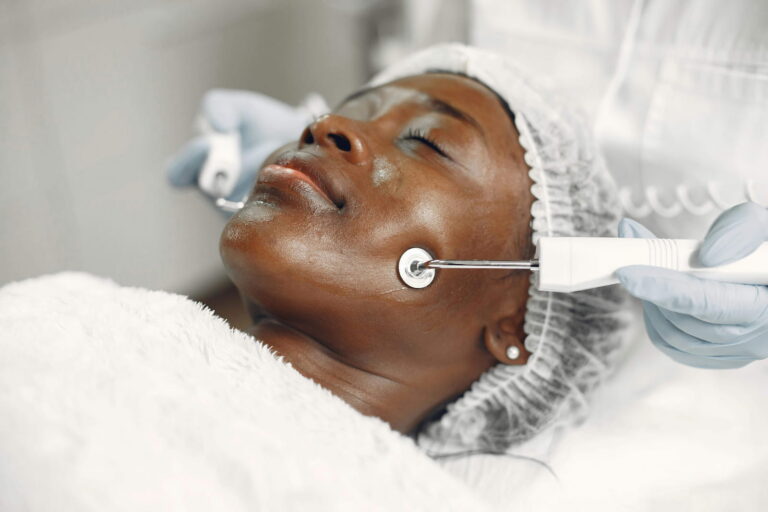 facelift recovery