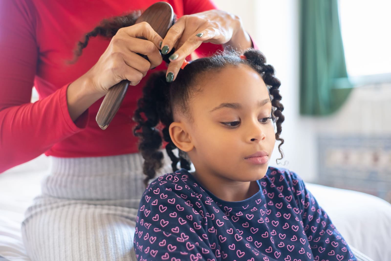 traction alopecia research