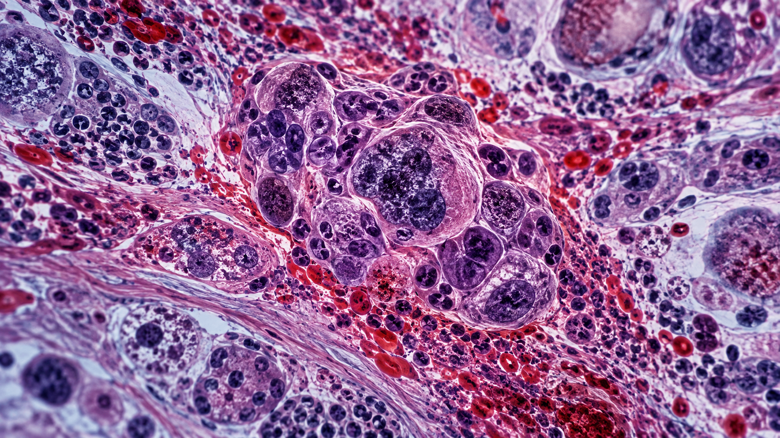 8 Diseases Where You Don’t See the Symptoms for Years